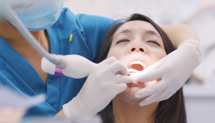 deep cleaning teeth