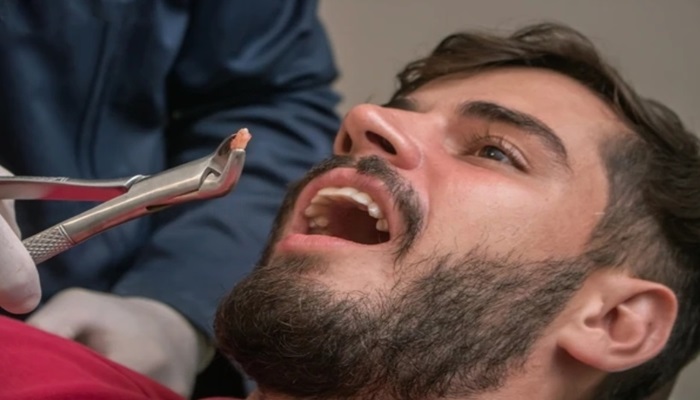 emergency tooth extraction