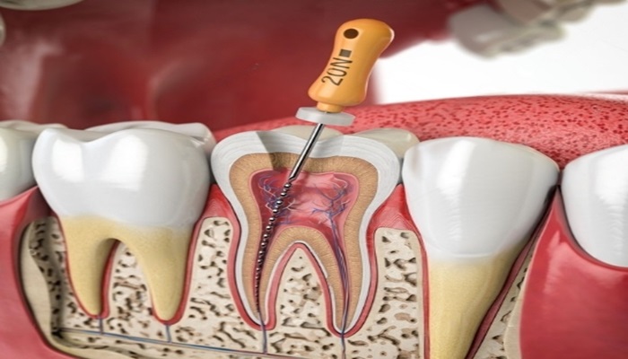 periodontal